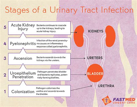 Urinary tract infection (lower)